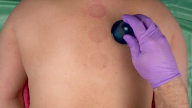 Elinde anti-selülit vakum silikon vücut kavanozları tutan tıbbi eldiven var. Selülit, soğuk algınlığı ve omurga ağrısına karşı mücadele için masaj ve sağlık prosedürleri. Kavanoz kan dolaşımını hızlandırır