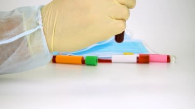 Vakum tüpünde kan örneği tutuyor. Hızla yayılan Coronavirus COVID-19 için pozitif test sonuçları.
