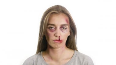 Beyaz arka planda çürükleri olan bir kız.