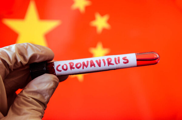 hand holding test tube with corona virus on China flag background, covid19 concept