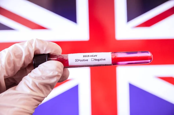 Büyük Britanya bayraklarında Corona virüsü olan el ele tutuşmalar, covid19 konsepti