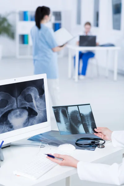 Vergleich der Röntgenergebnisse mit der Diagnose eines Patienten — Stockfoto