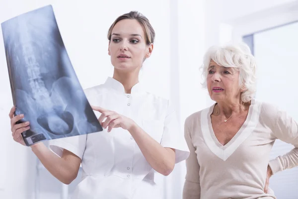 La foto de rayos X de la columna vertebral —  Fotos de Stock