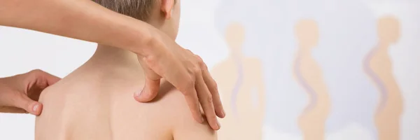 Boy with scoliosis — Stock Photo, Image