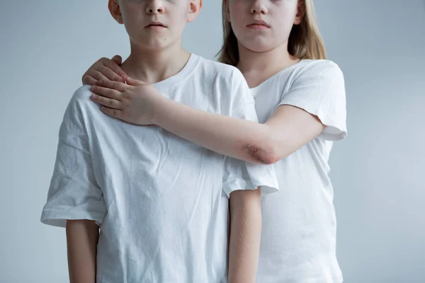 Çocuklara karşı fiziksel saldırganlık — Stok fotoğraf