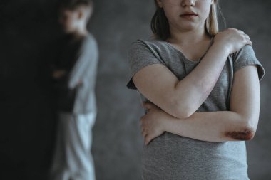 Cinsel taciz kurbanı