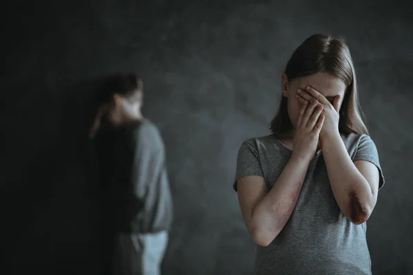 Menina com hematomas — Fotografia de Stock