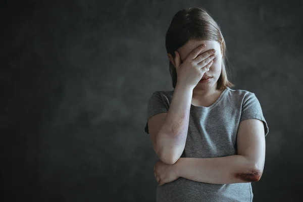 Victim of sexual abuse — Stock Photo, Image