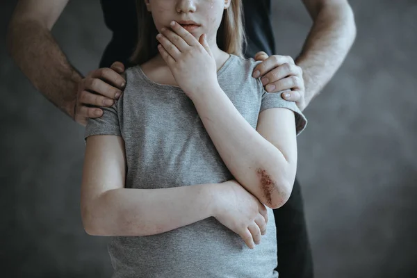 Девушка с поврежденным локтем — стоковое фото