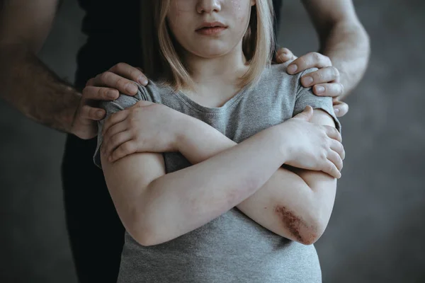 Дівчина з закритими руками — стокове фото