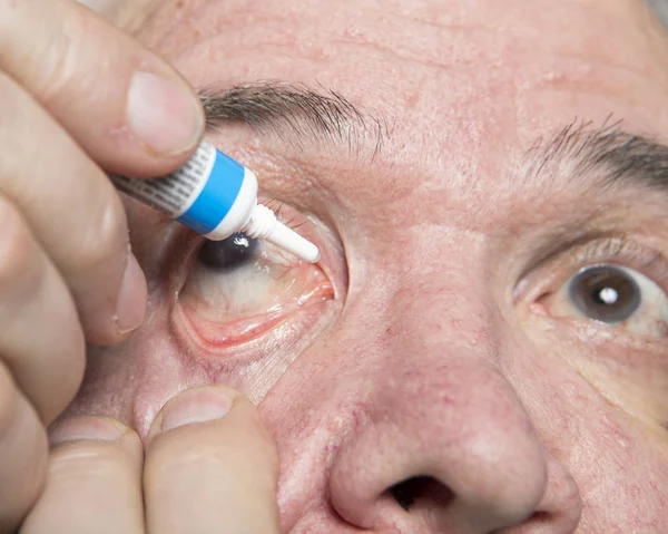 Tratamiento de enfermedades oculares — Foto de Stock