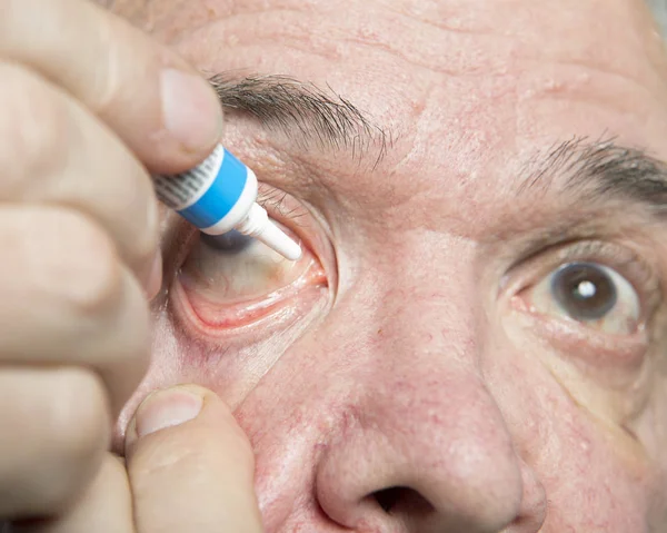 Behandlung von Augenkrankheiten — Stockfoto
