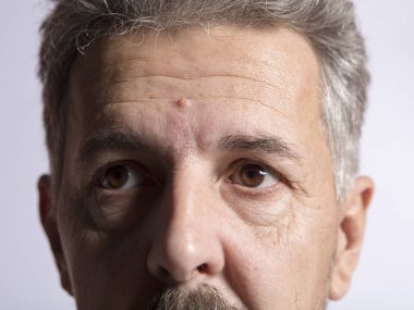 Göz hastalığı ilk aşaması