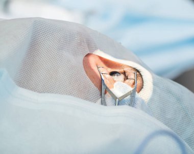 Kristal lens değiştirilebilir cerrahi yöntemi