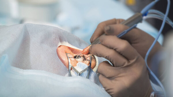 Crystalline lens replaceable surgical method