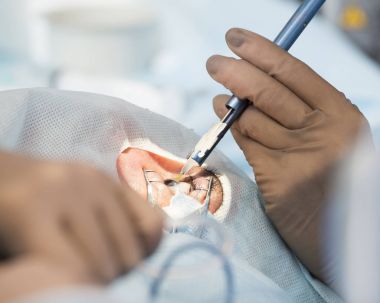 Kristal lens değiştirilebilir cerrahi yöntemi