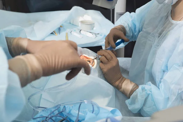 Lente cristalina método quirúrgico reemplazable —  Fotos de Stock