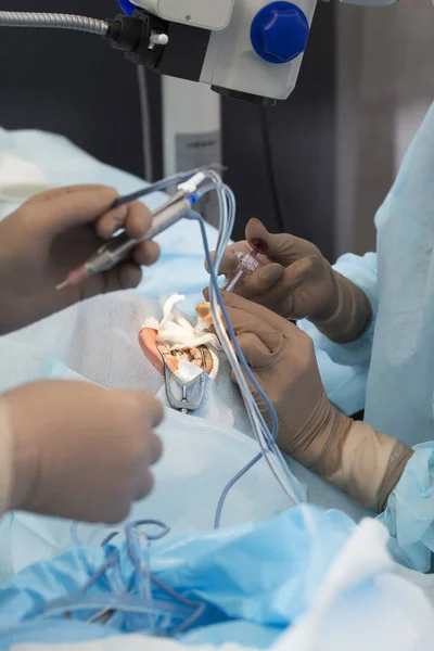 Linsemulsionsbildning, förstörelse av ogenomskinlig linsen i ögat b — Stockfoto