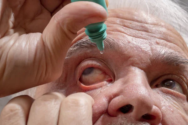 Elderly man buries medicine in his eyes