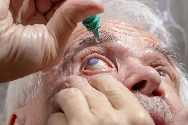 Anciano entierra medicina en sus ojos — Foto de Stock