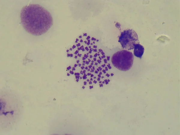 İnsan kromozomlarının mikroskobik görüntüsü (1000x) — Stok fotoğraf