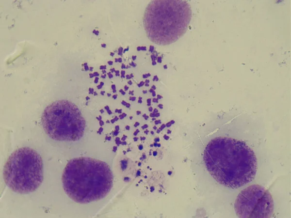 Chromosomes humains au microscope photonique. (grossissement 1000x ) — Photo
