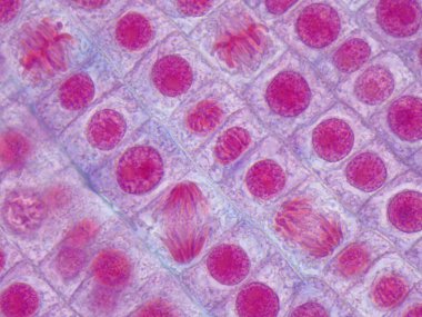Mikroskobik görüntüde soğan kökü hücreleri mitozdan geçiyor. Anafazlar ve metafazlar. 1000x büyütülmüş