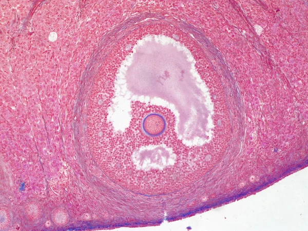 Mikroskopijny Obraz Pęcherzyka Jajnikowego Komórką Jajową Ludzkim Jajniku 100X Powiększenie — Zdjęcie stockowe