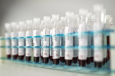 Corona virüsü testlerinin pozitif sonuçları. Laboratuvarda özel tutucuda bir sürü kan testi tüpü var..