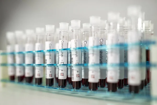 Положительные Результаты Тестов Коронный Вирус Многие Трубки Анализа Крови Специальном — стоковое фото