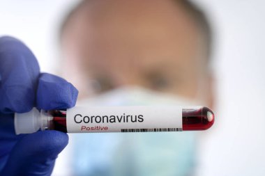Koruyucu maske takan ve koronavirüs testinin olumlu sonuçlarını gösteren ciddi bir adam..