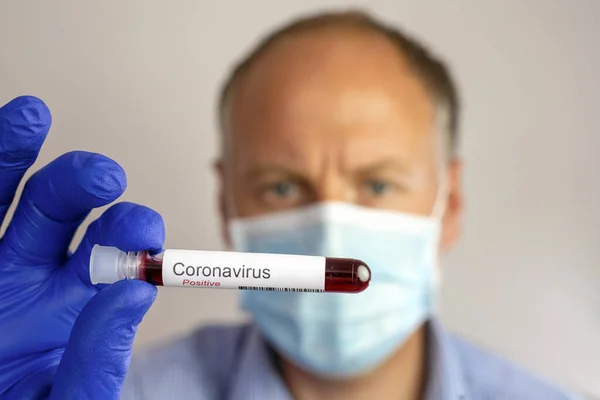 Ein Seriöser Mann Mit Schutzmaske Und Positivem Ergebnis Seines Coronavirus Stockfoto