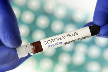 Koronavirüs testleri salgının sonunun sembolü olarak negatif sonuç verdi. Laboratuvarda özel tutucuda arka plan olarak pek çok kan testi tüpü var..