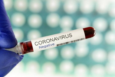 Koronavirüs testleri salgının sonunun sembolü olarak negatif sonuç verdi. Laboratuvarda özel tutucuda arka plan olarak pek çok kan testi tüpü var..