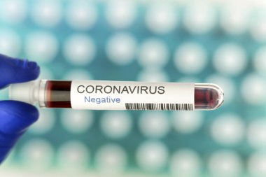 Koronavirüs testleri salgının sonunun sembolü olarak negatif sonuç verdi. Laboratuvarda özel tutucuda arka plan olarak pek çok kan testi tüpü var..