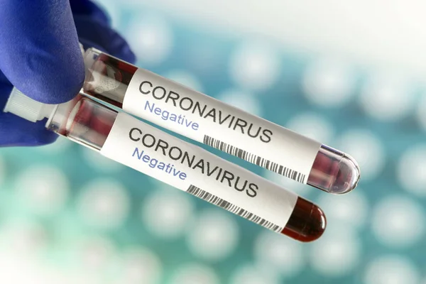 코로나 바이러스 검사를 세계적 유행병 것이라는 부정적 결과가 나왔습니다 실험실의 — 스톡 사진