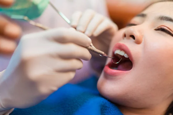 Nahaufnahme Frau Lässt Zähne Untersuchen Zahnarzt Check Bagger Klinik Ihre — Stockfoto