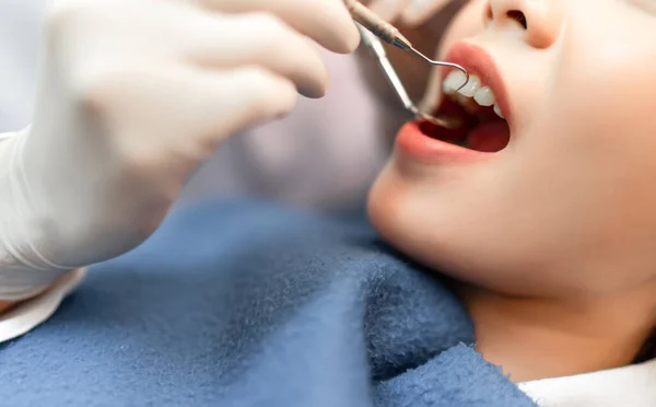 Mujer Cerca Que Tiene Dientes Dentales Examinados Dentista Chequeo Través — Foto de Stock