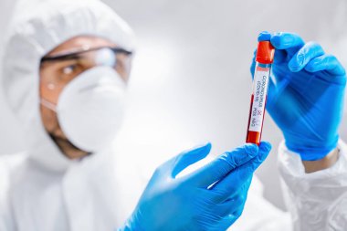 Erkek doktor bilim adamı, klinik laboratuarında Coronavirus araştırması için kan örneği içeren test tüpü tutuyor.