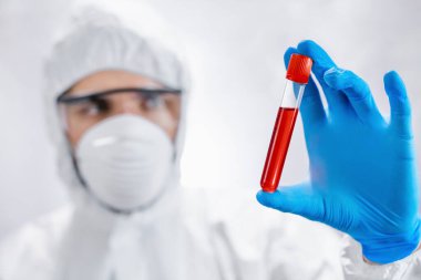 Erkek tıp bilimci virüs analizi için kanla test tüpü tutuyor.