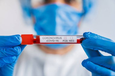 Genç bilim adamının elinde Coronavirus pozitif araştırması için kan örneğiyle klinik laboratuarında deney tüpü tutmasına yakın durun.