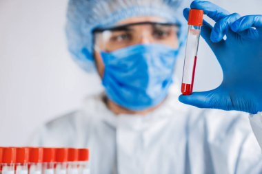 Epidemiyoloji uzmanı virüs karantinasında tıbbi örnek test tüpü kullanıyor.