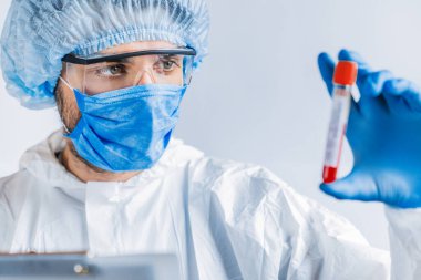 Salgının önlenmesi için laboratuvarda virüs araştırması