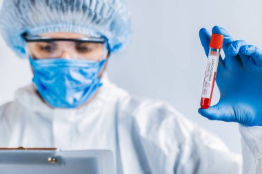 Epidemiyoloji uzmanı kan örneği tutuyor. Tüpe odaklı virüs testi ve araştırma konsepti