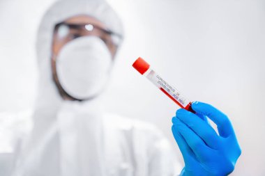 Maske takan ve koruyucu kostüm giyen bir doktor laboratuvarda test tüpündeki kalın kan örneğini inceleyerek Covid virüs araştırması geliştiriyor.