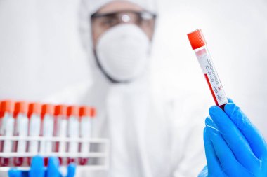 Koronavirüs için kan örneği tutan kimyasal koruyucu kıyafetli genç bilim adamı test tüpüne odaklan.