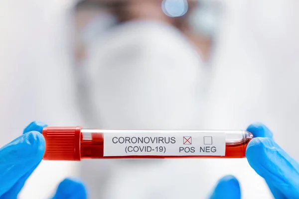 Klinik Laboratuarında Coronavirus Araştırması Için Test Tüpü Tutan Genç Bilim — Stok fotoğraf