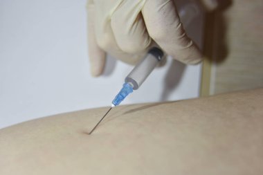 The procedure of intramuscular injection, close-up