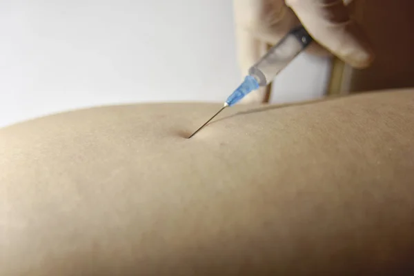 The procedure of intramuscular injection, close-up Stock Picture