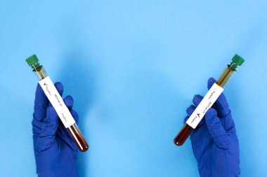 Doktor içinde kan olan bir test tüpü tutuyor. Yeni bir koronovirüs ile enfeksiyon testi. Çin 'in yeni virüsü 2019-nCoV